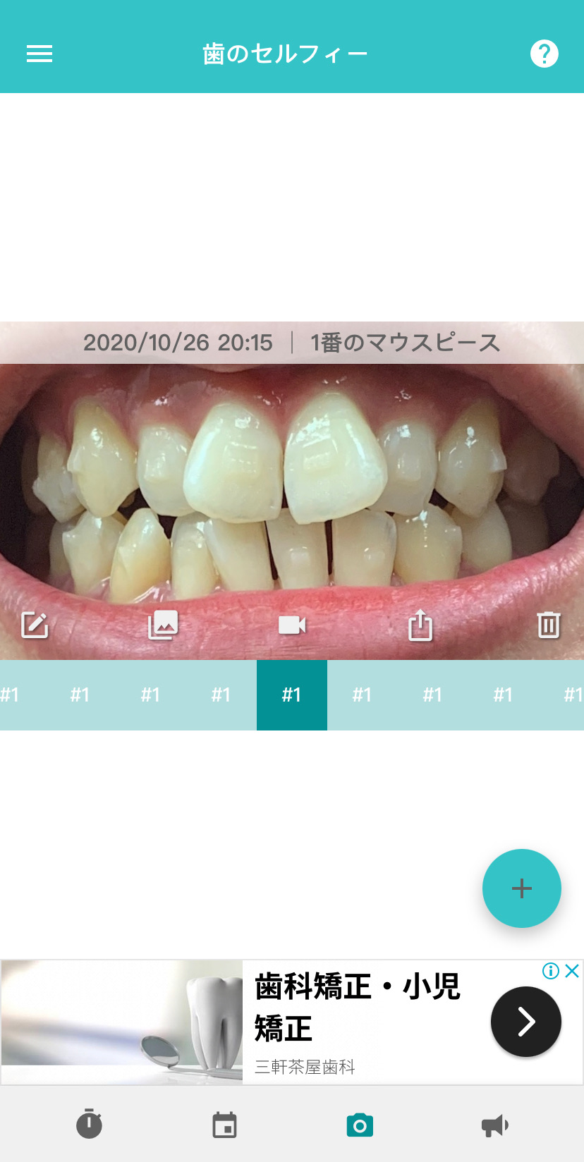 【無料】インビザライン歯科矯正用アプリ"TrayMinder"の使い方を解説【スマホ、Apple Watch版】