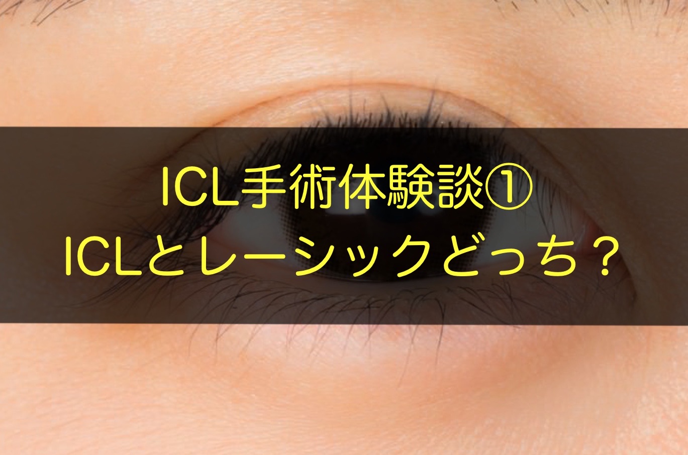 ICL手術体験談①【ICLとレーシックどっち？】